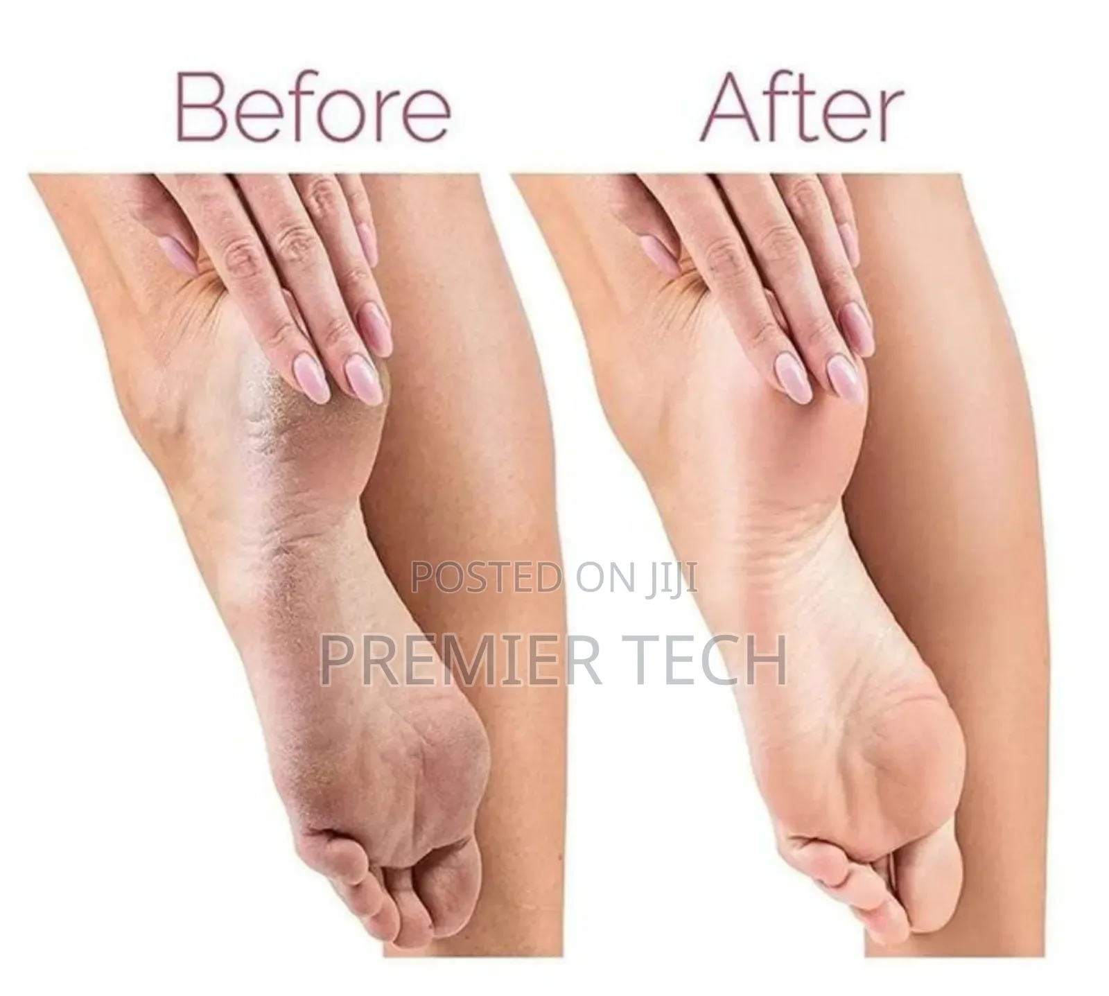 Pedi Callus Remover With Extra Grinder Tool