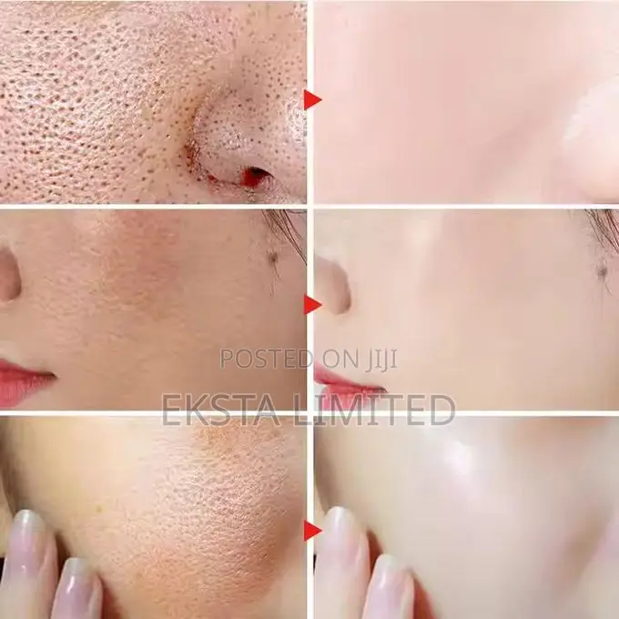 Mooyam 5 In1 Super Facial Serum