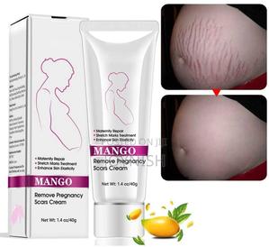 New Stretch Mark Cream Removes Stretch Marks Easily - thumbnail 2