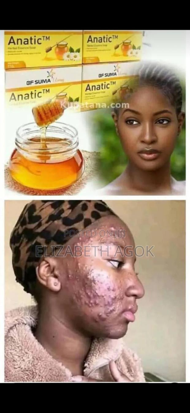 Anatic Soap - thumbnail 2