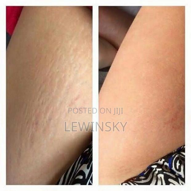 Strechmarks Body Oil - thumbnail 3