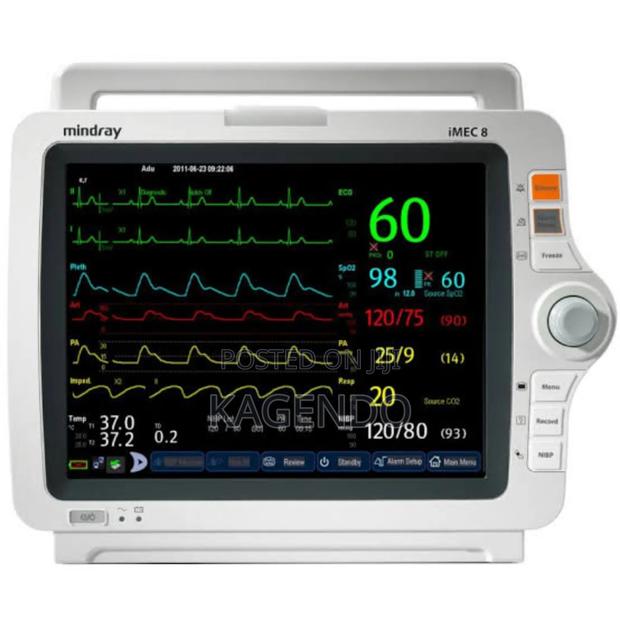 Mindray 5-Parameter Patient Monitor - main view