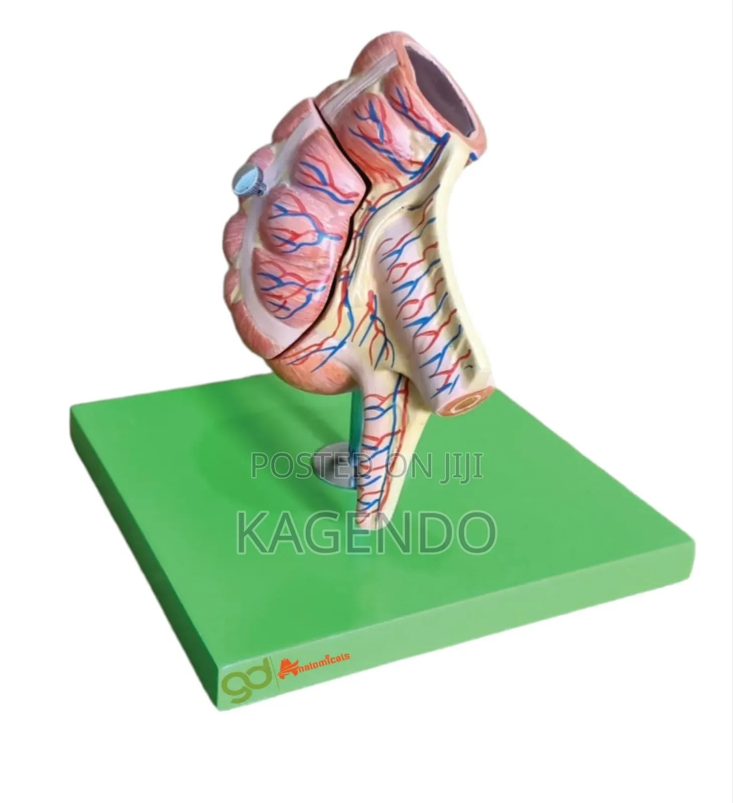 Appendix Model – Anatomical Educational Tool