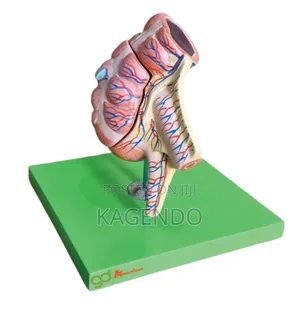 Appendix Model – Anatomical Educational Tool