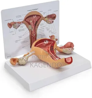 Female Genitalia Model – Anatomical Educational Tool