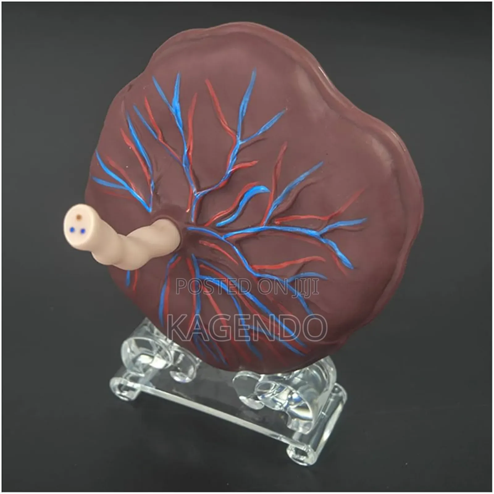 Placenta Model – Obstetrics Gynecology Training