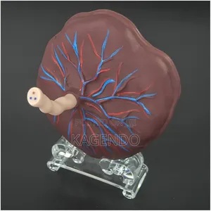 Placenta Model – Obstetrics Gynecology Training
