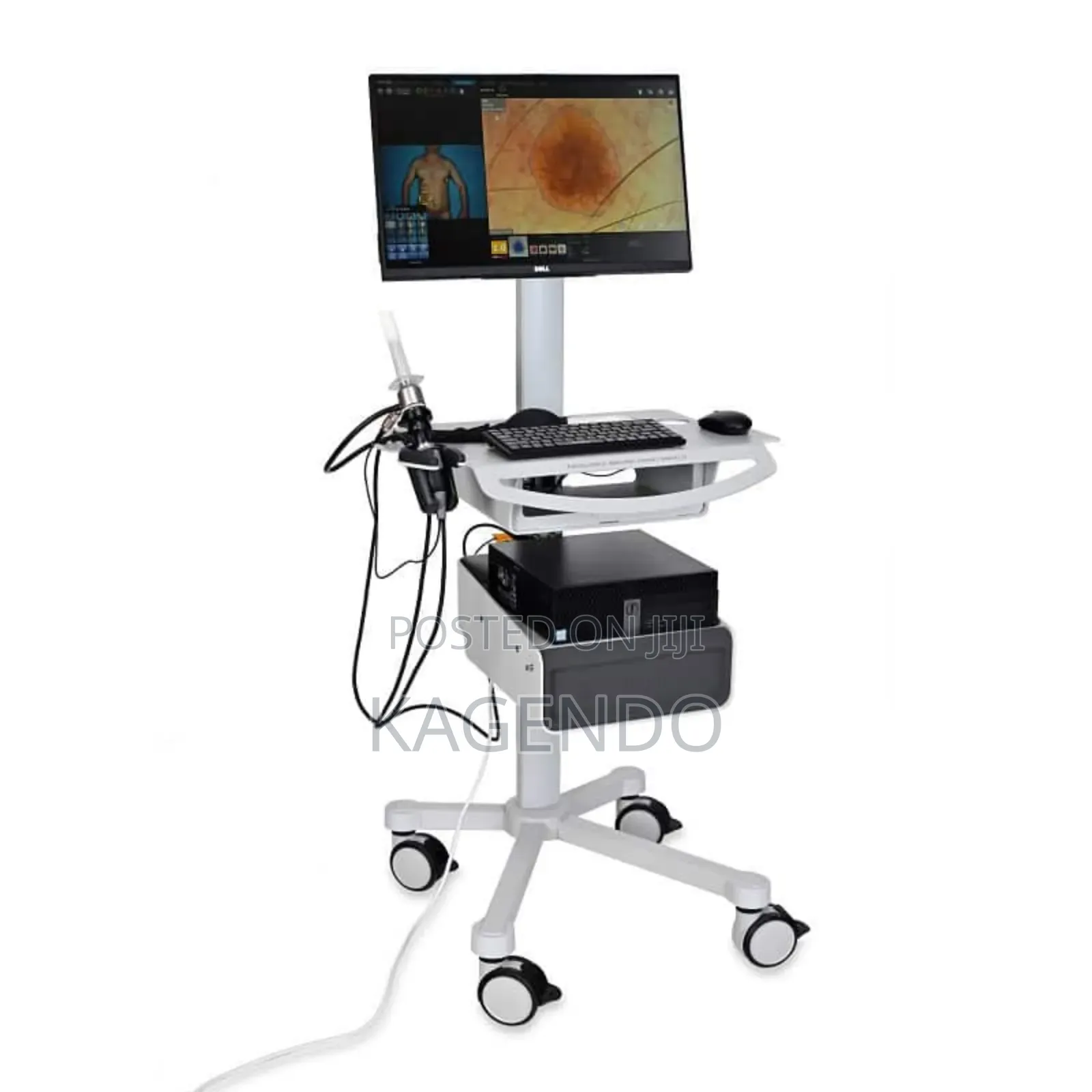 Anal Rectal Endoscope – Precision Diagnostic Tool