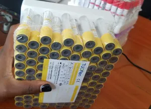 Vacutainers Yellow Tops