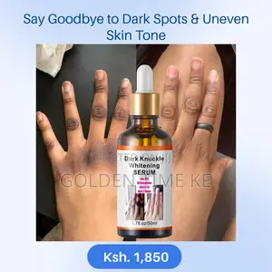 50ml Dark Knuckles, Elbows and Knees Even Tone Serum