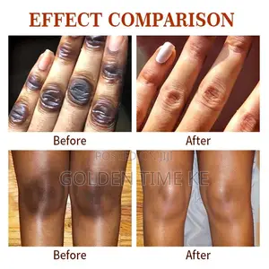 50ml Dark Knuckles, Elbows and Knees Even Tone Serum