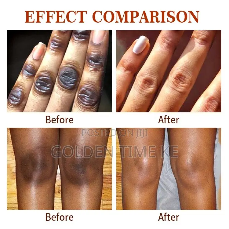50ml Dark Knuckles, Elbows and Knees Even Tone Serum