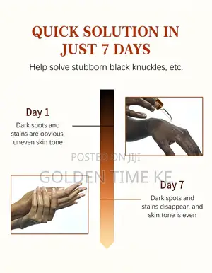 50ml Dark Knuckles, Elbows and Knees Even Tone Serum