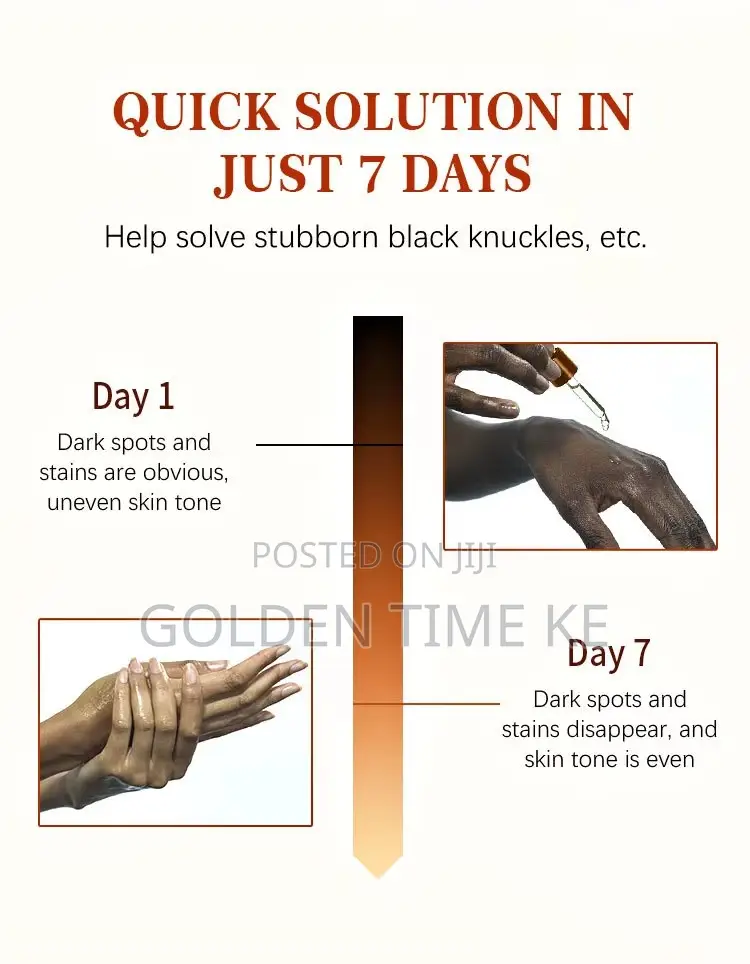 50ml Dark Knuckles, Elbows and Knees Even Tone Serum