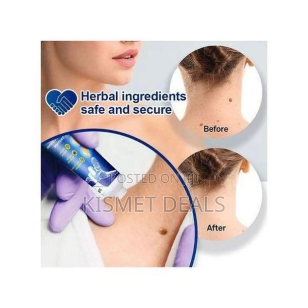 Sumifun Warts Remover Moles Skin Tag Ointment