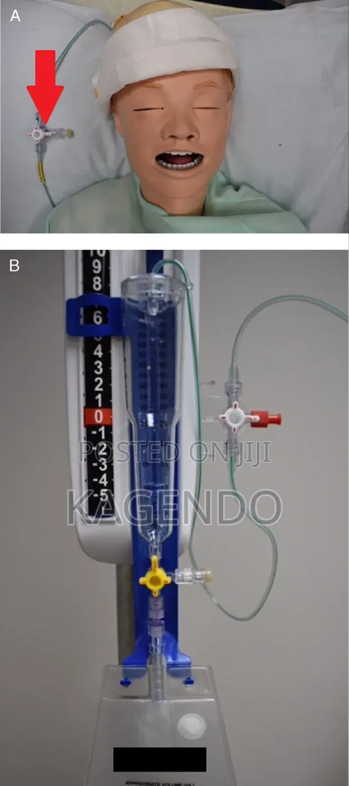 External Ventricular Drain (Evd)