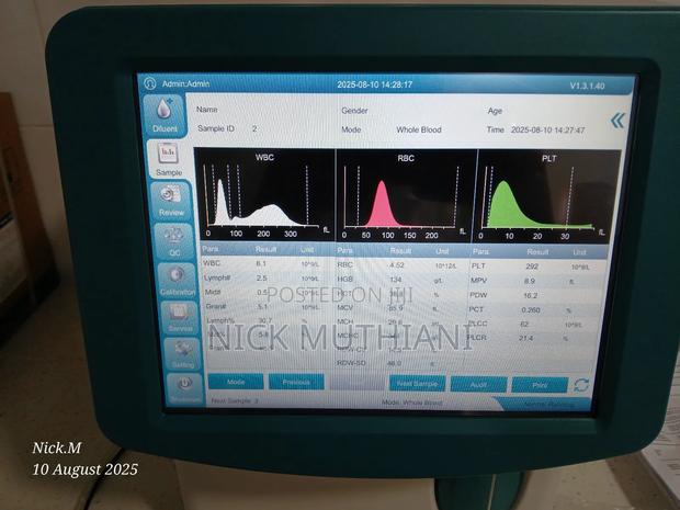 Bioelab Ec 30 Haematology Analyzer - thumbnail 5