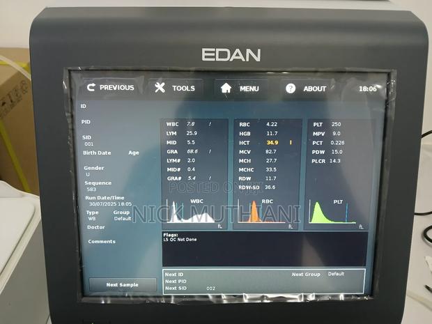 Edan H30 Haematology Analyzer - thumbnail 3