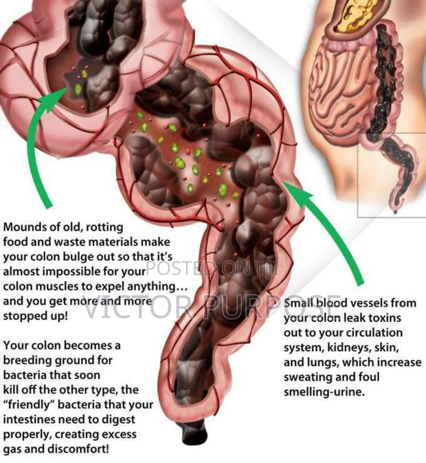 Superlife Colon Care (Scc+) - thumbnail 6