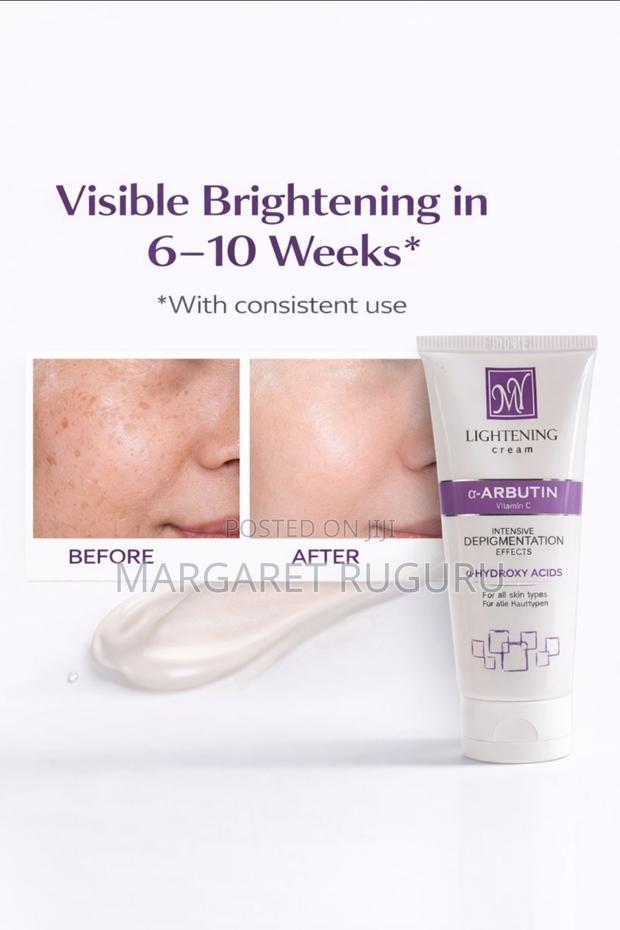Alpha Arbutin + Vitamin C Cream for Uneven Tone, Dark Spots, Melasma