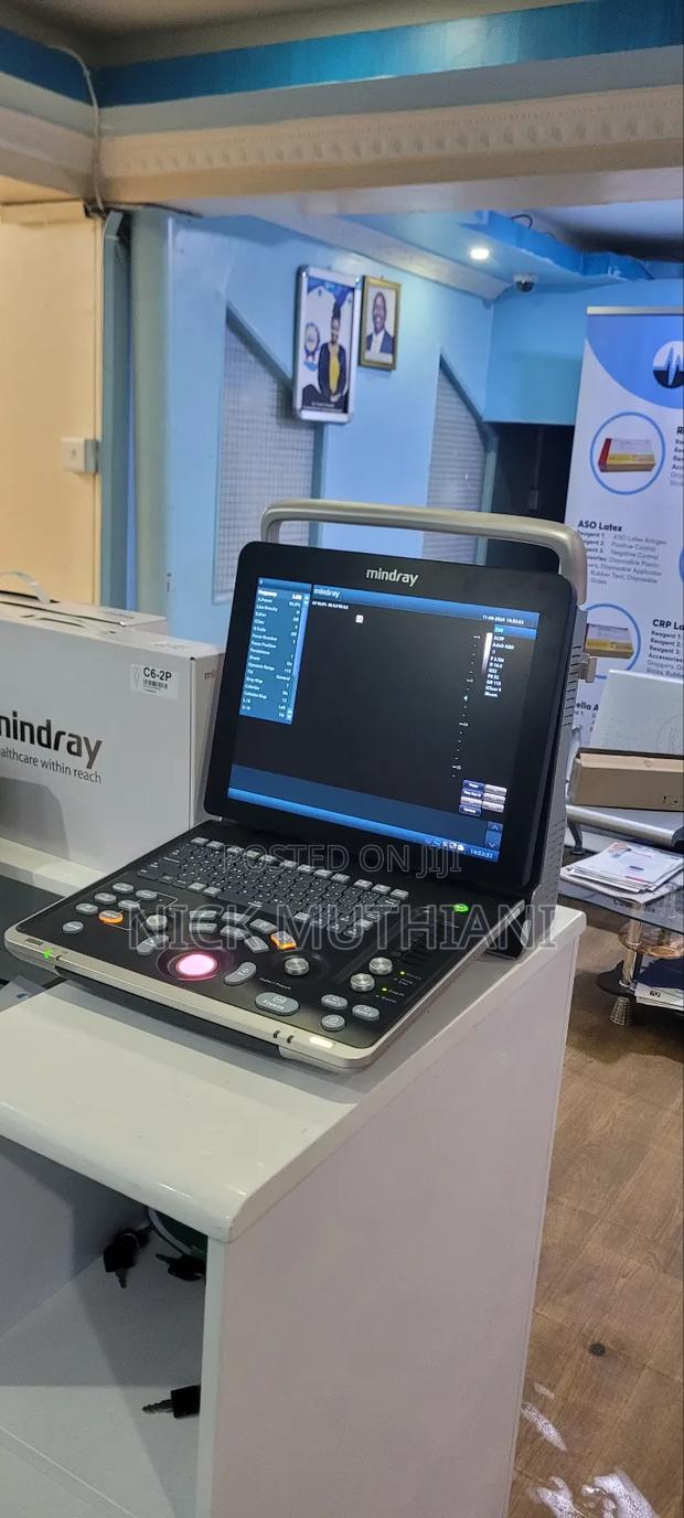 Mindray Dcn2 Ultrasound - Colour Doppler - thumbnail 2