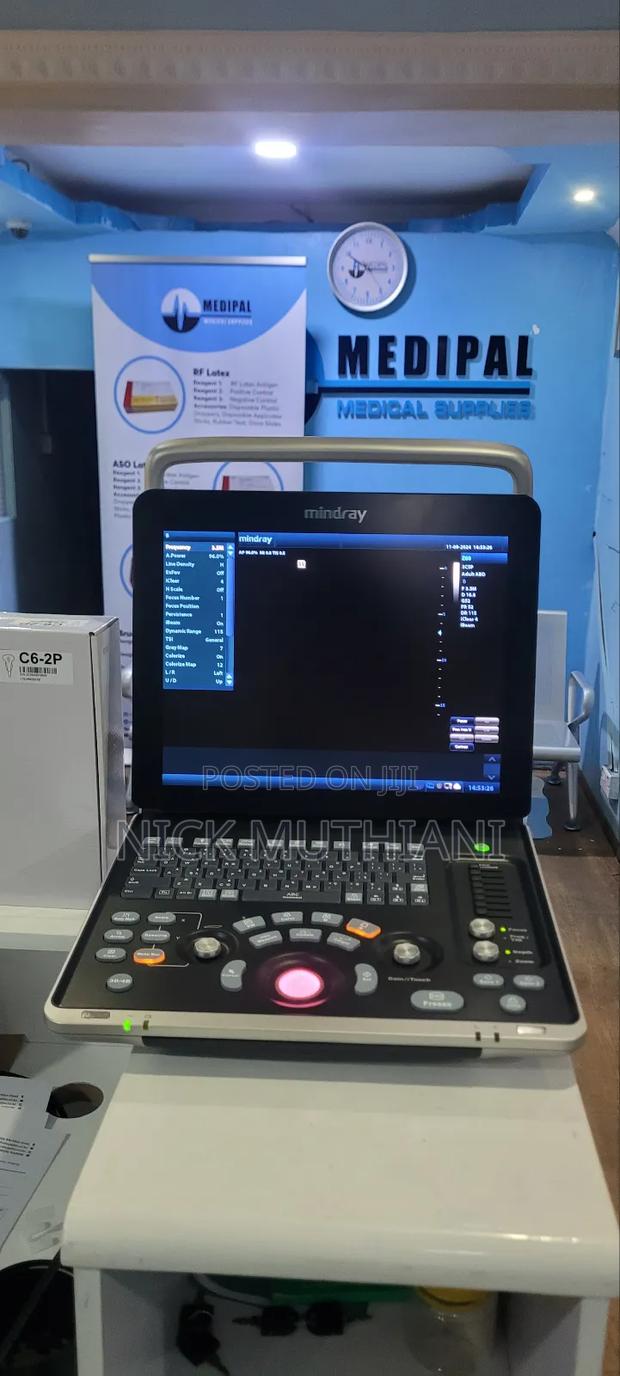 Mindray Dcn2 Ultrasound - Colour Doppler - thumbnail 3