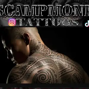 Tattoo Removal
