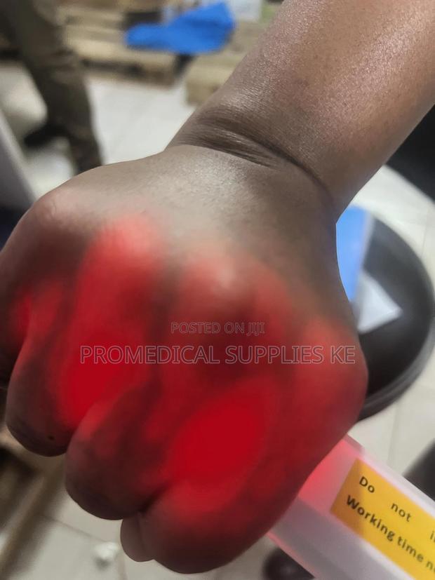 Vein Finder - thumbnail 2