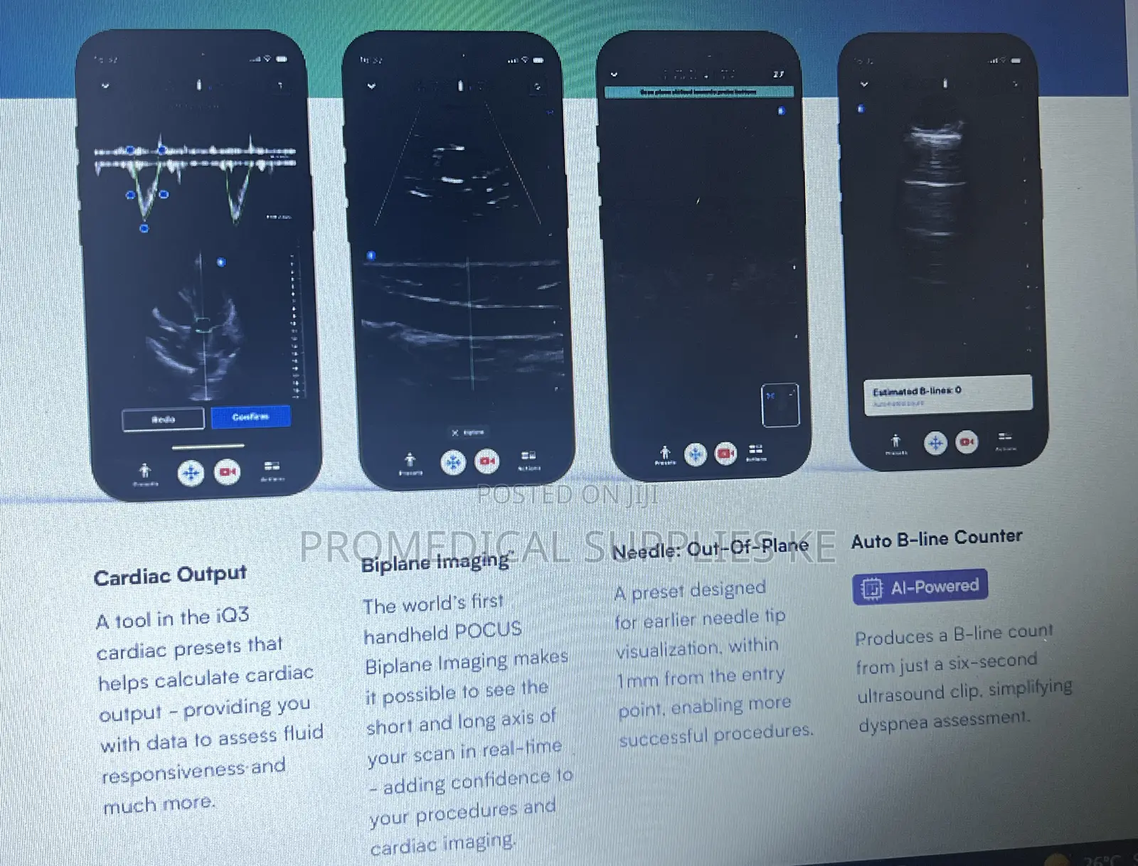 Butterfly Iq3 Pocus