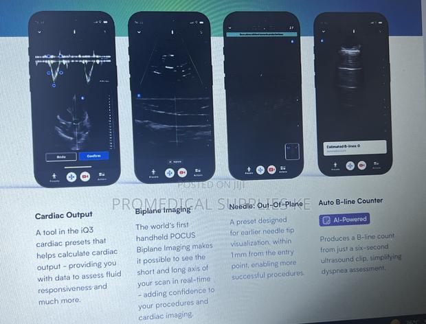 Butterfly Iq3 Pocus - thumbnail 4