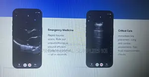 Butterfly Iq3 Pocus