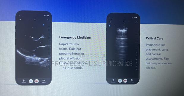 Butterfly Iq3 Pocus - thumbnail 2