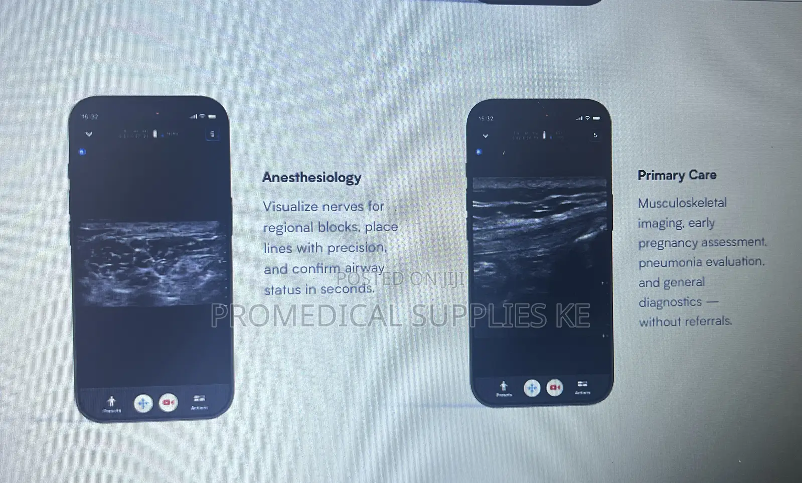 Butterfly Iq3 Pocus