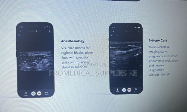 Butterfly Iq3 Pocus - thumbnail 3