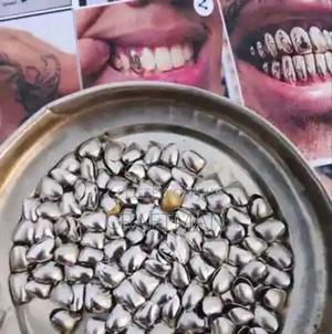 Removable Silver and Gold Tooth Caps - main view