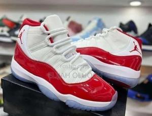 Jordan 11 Cherry 🍒 🐾Pure 🫰🏿 - thumbnail 2