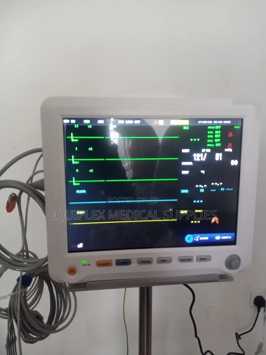 5 Parameter Patient Monitor (Yonker Brand)