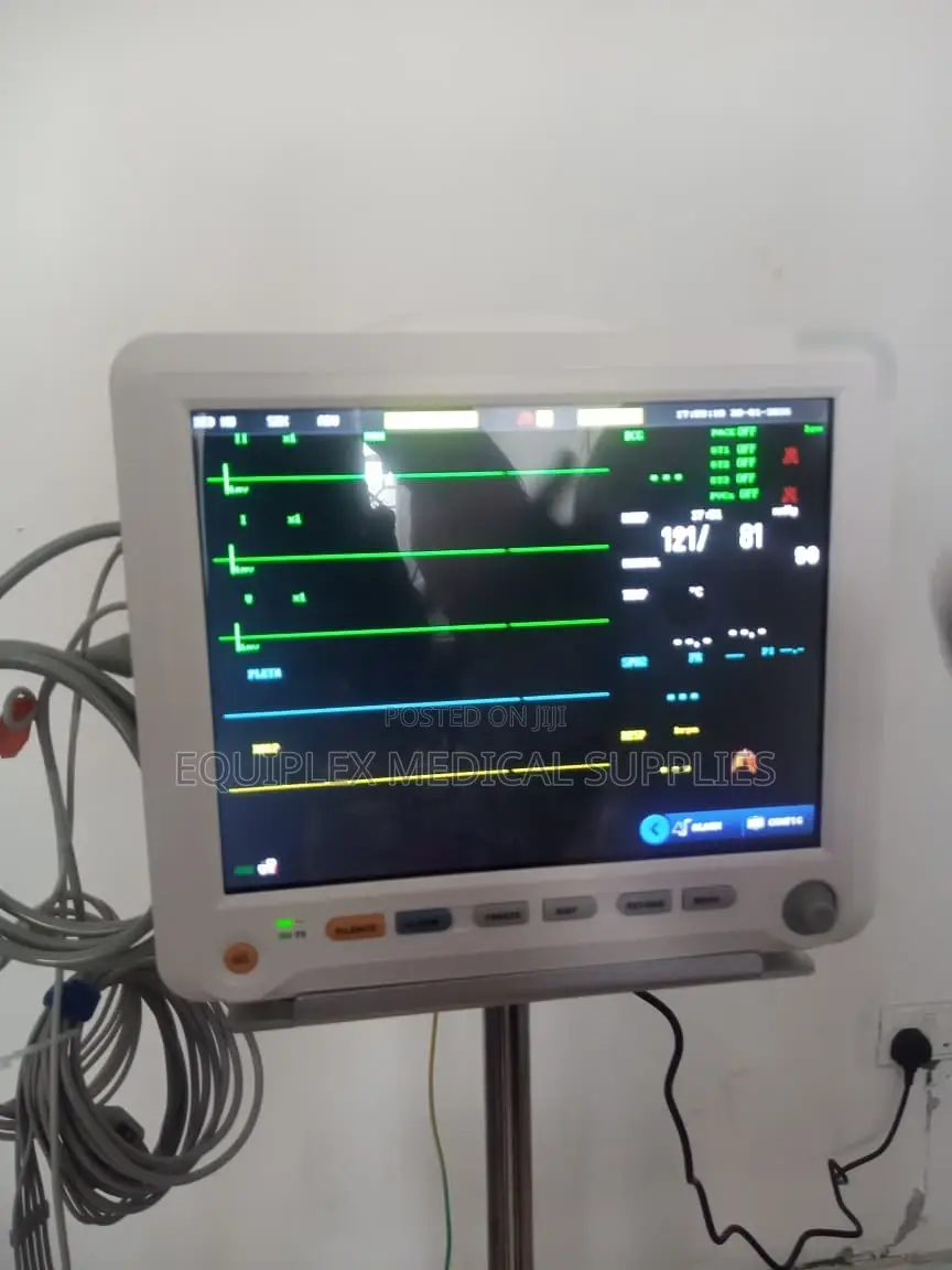 5 Parameter Patient Monitor (Yonker Brand)