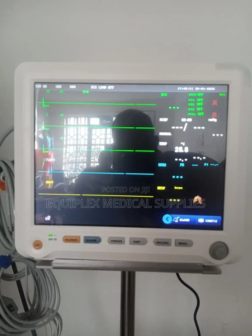5 Parameter Patient Monitor (Yonker Brand)