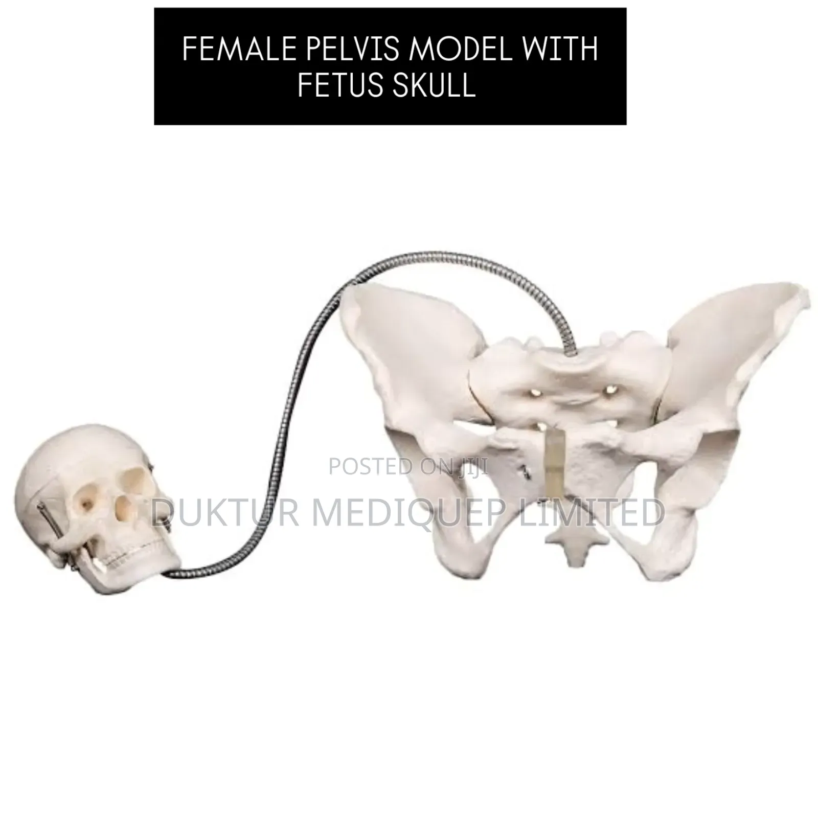 Female Pelvis Model With Fetus Skull