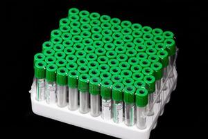 Green Top Vacutainer - main view