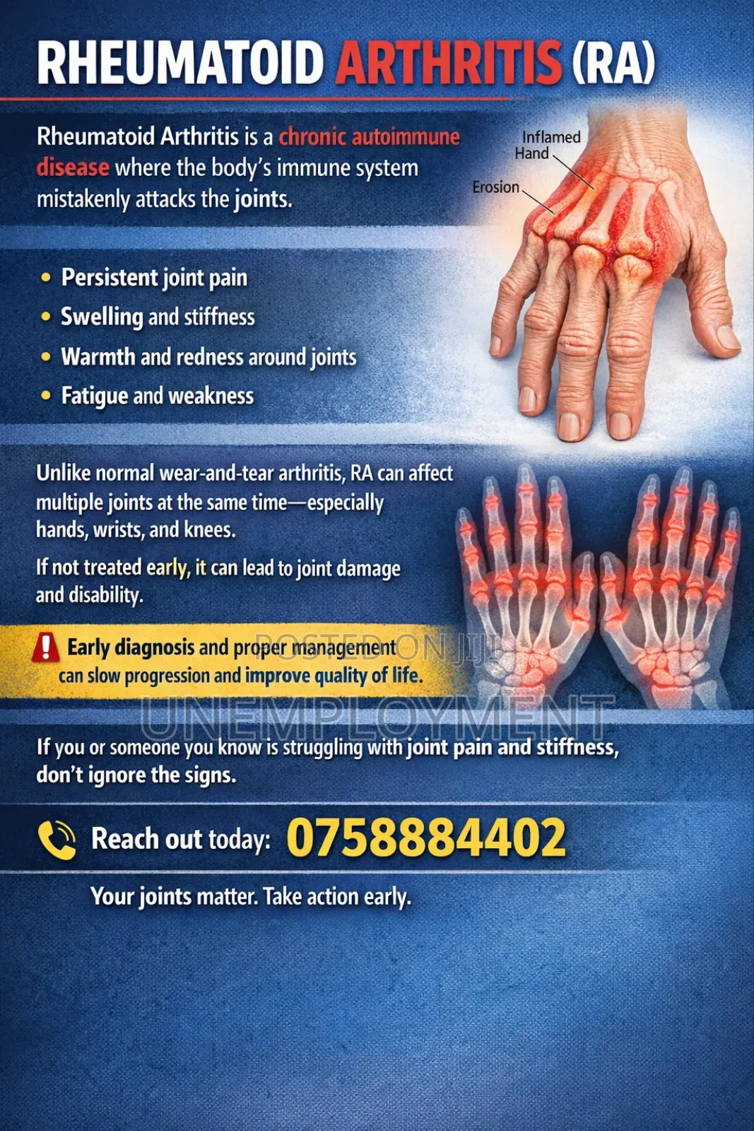 Arthritis Products