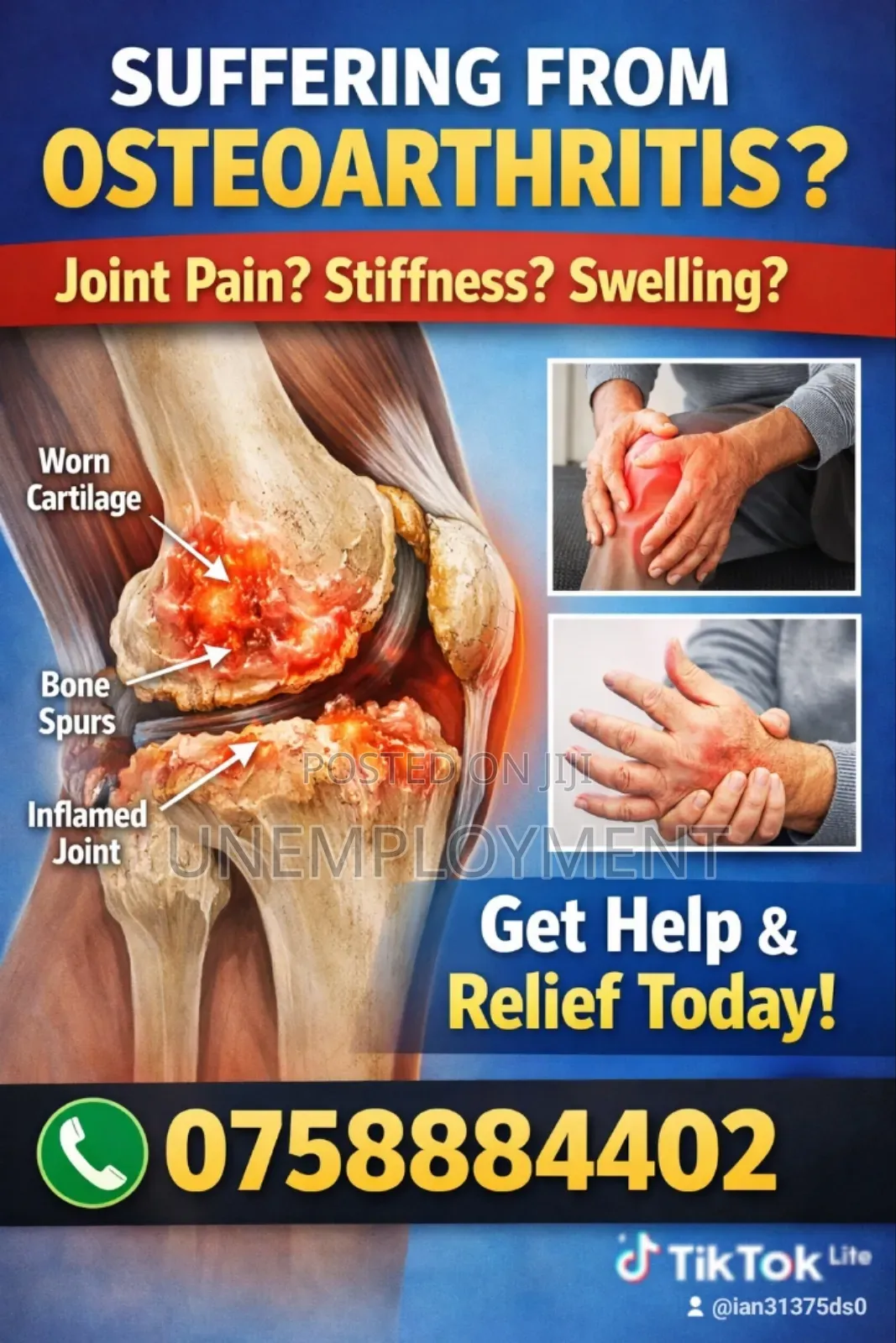 Arthritis Products