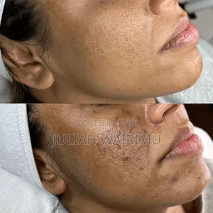 Keopi Glow Collagen Coffee – For Glowing Skin Energy