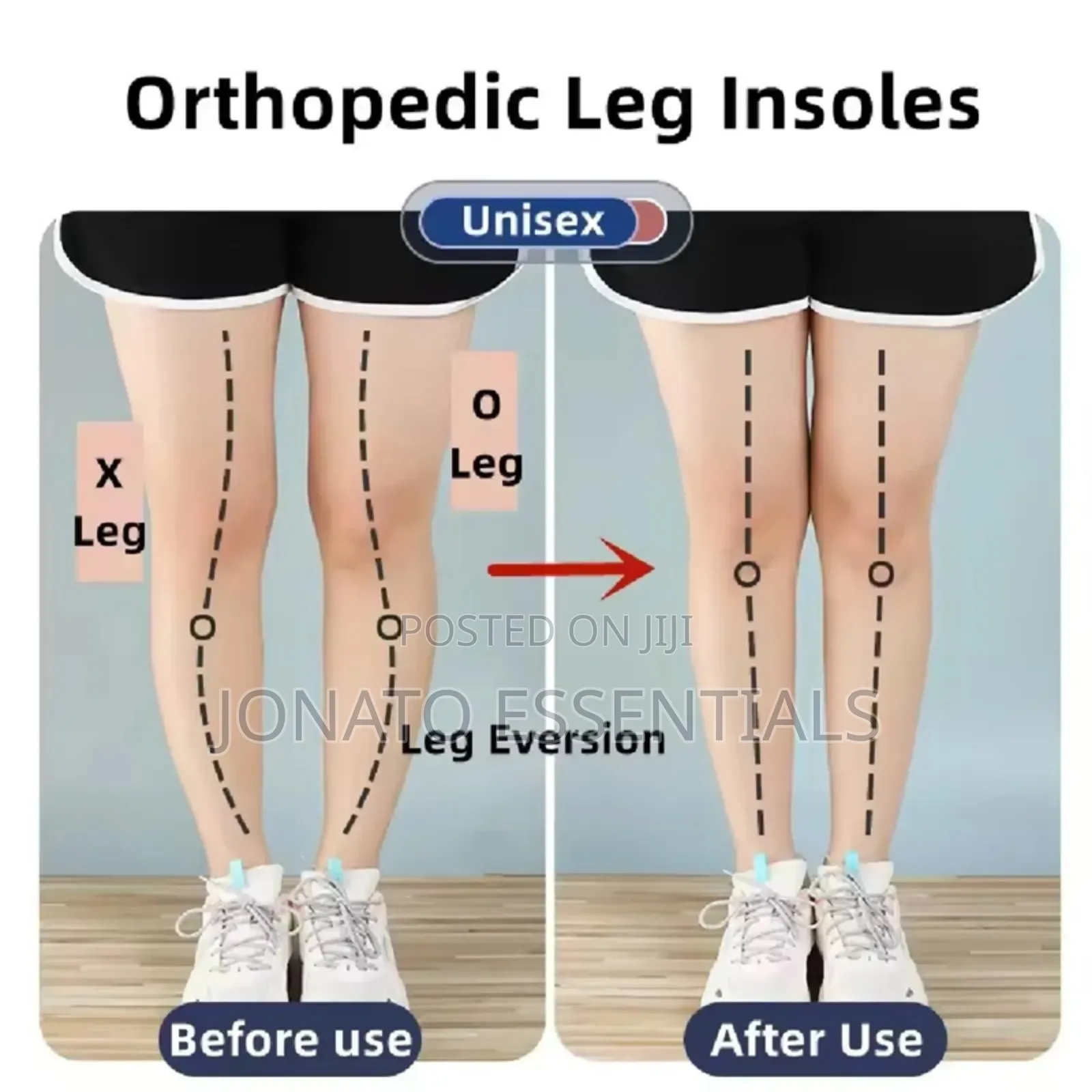 Orthopedic Silicone Heel Insoles for O/X Leg Correction