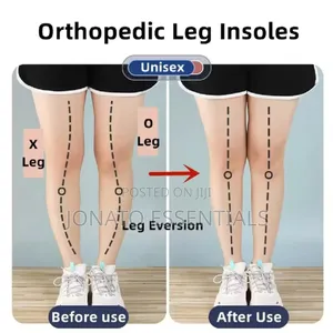 Orthopedic Silicone Heel Insoles for O/X Leg Correction