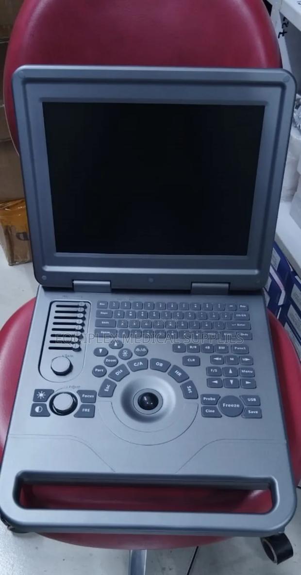 Ultrasound Machine With Transvaginal and Convex Probe - thumbnail 2