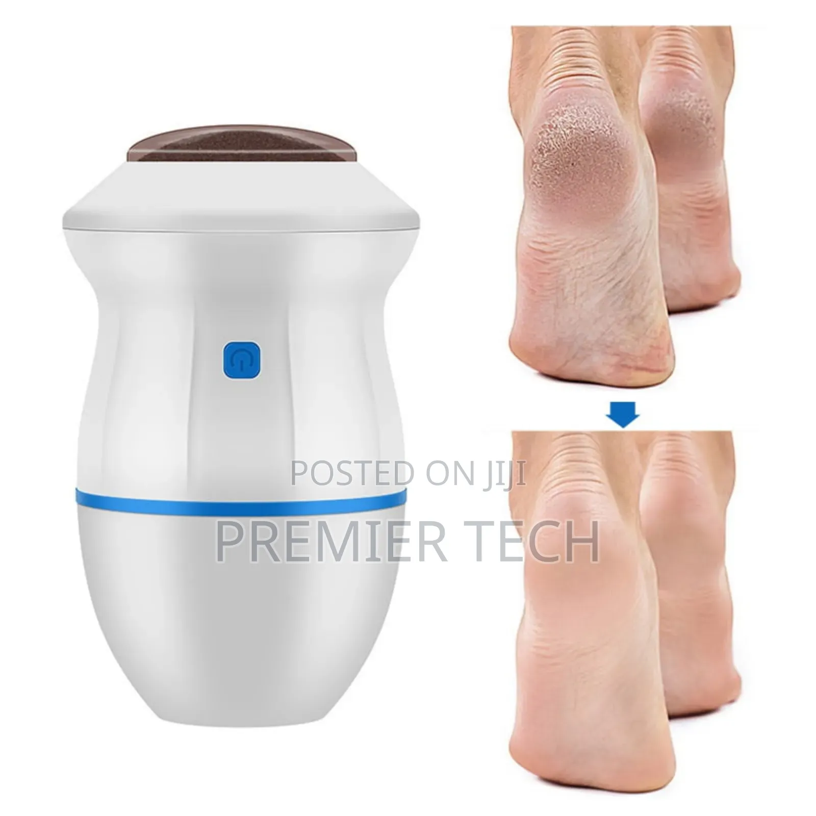 Foot File , Callous Remover