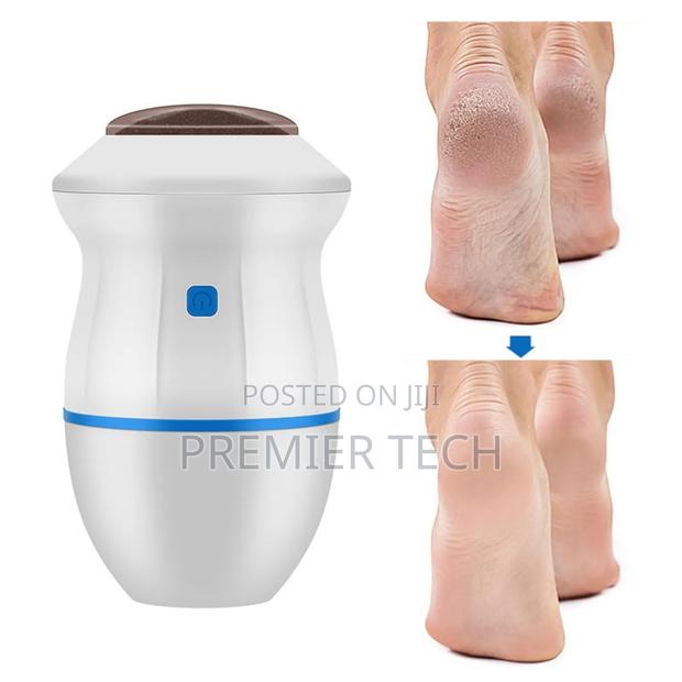 Foot File , Callous Remover