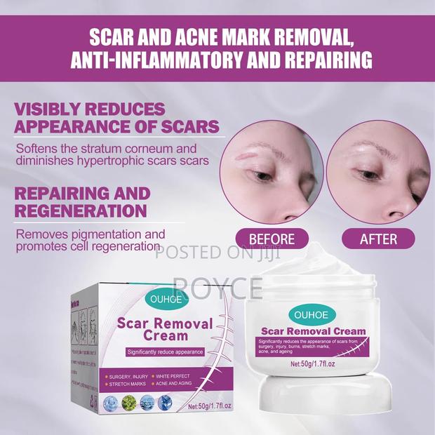 Scar Removal Cream - thumbnail 4